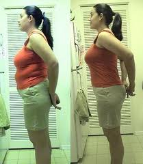 Hypnosis for weight loss - weight loss comparison lady
